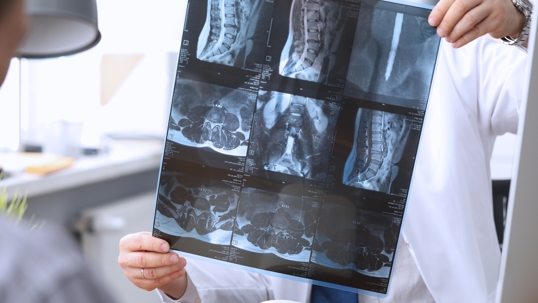 Person holding a picture of an xray